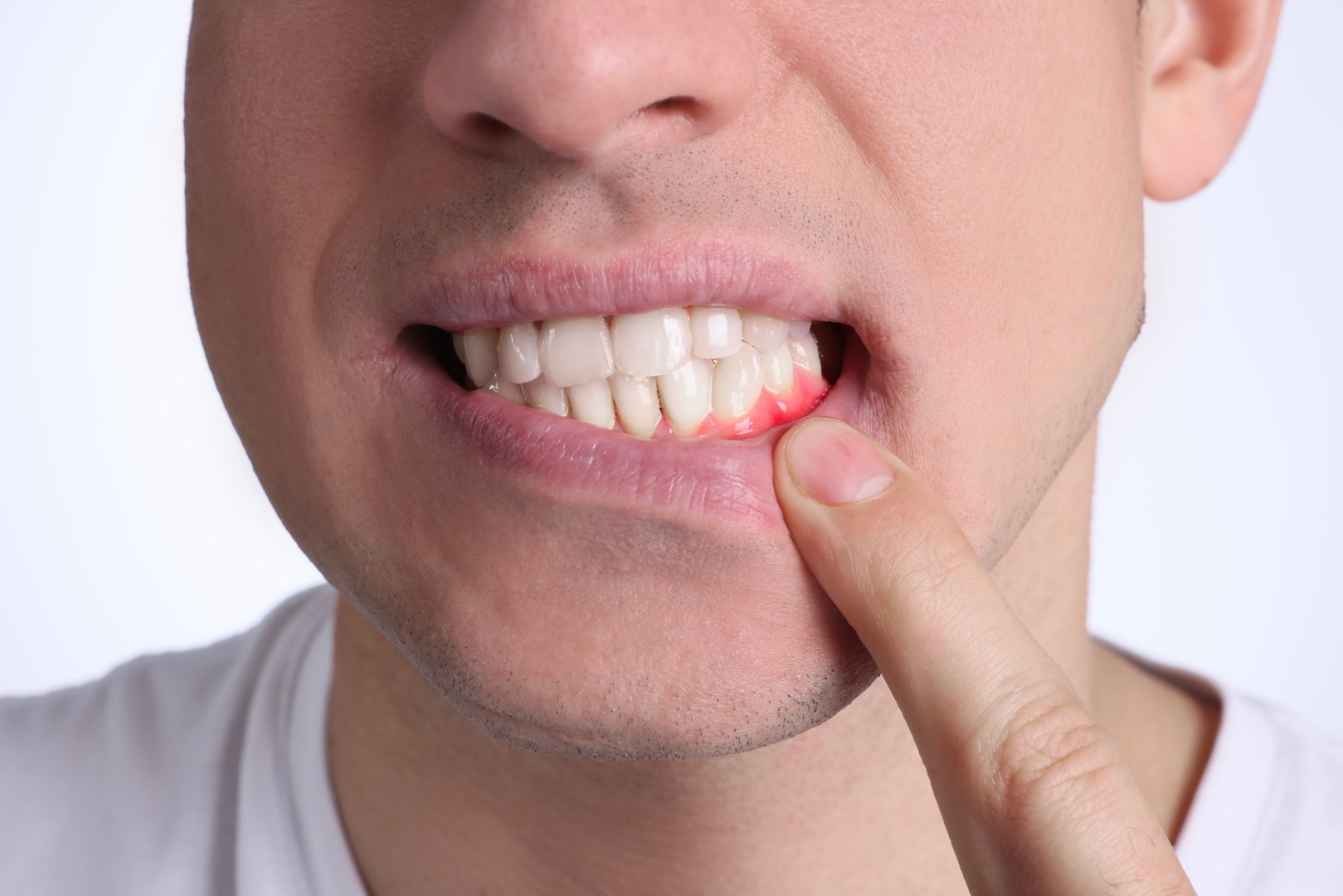 Tooth Ache Treatment